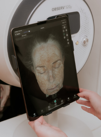 SKin Consultation